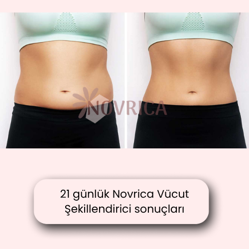 Novrica Vücut Şekillendirici