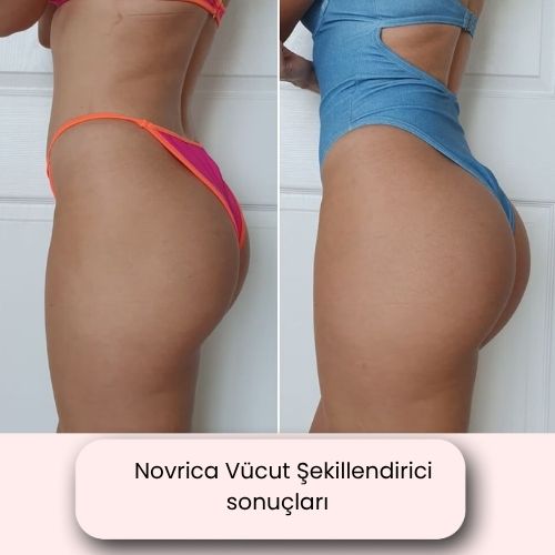Novrica Vücut Şekillendirici